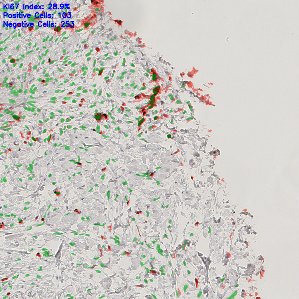 slice_44_17_x39424_y15232.png