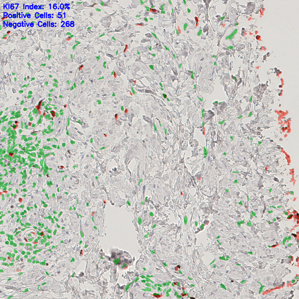 slice_44_18_x39424_y16128.png