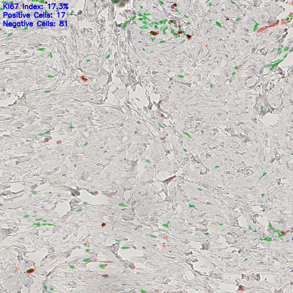 slice_44_19_x39424_y17024.png
