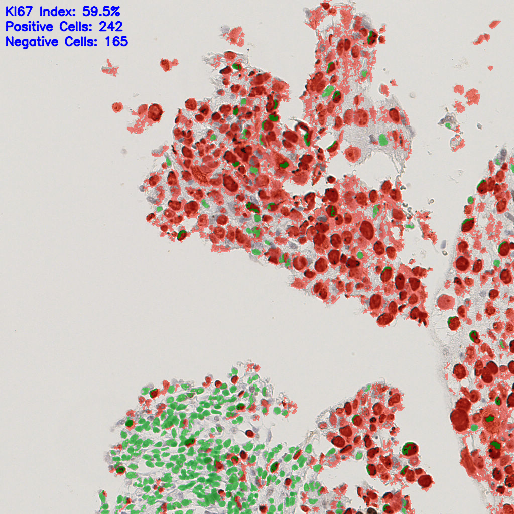 slice_45_13_x40320_y11648.png