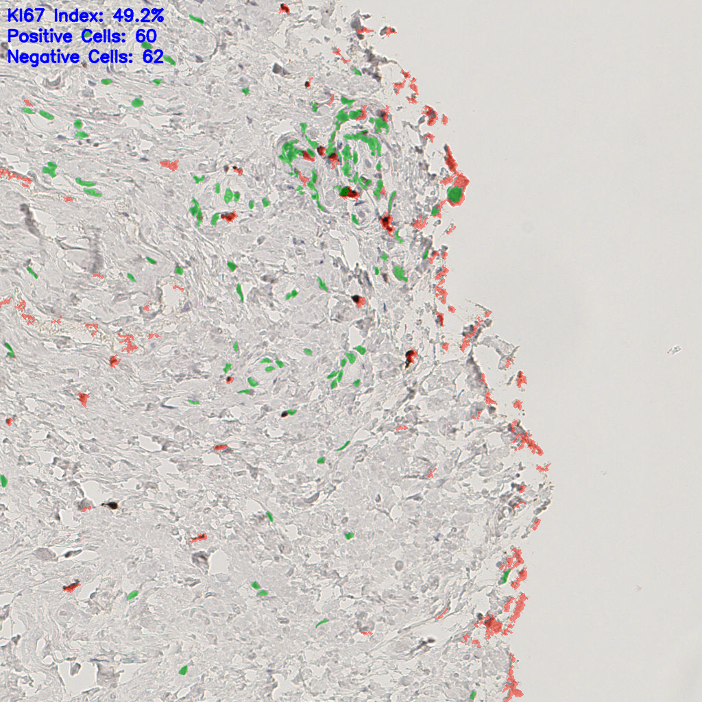 slice_45_20_x40320_y17920.png