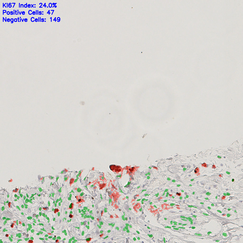 slice_47_12_x42112_y10752.png