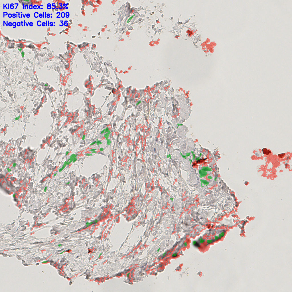 slice_47_23_x42112_y20608.png