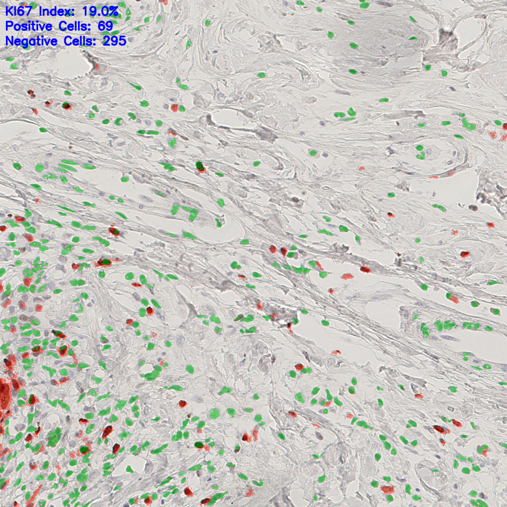 slice_48_13_x43008_y11648.png