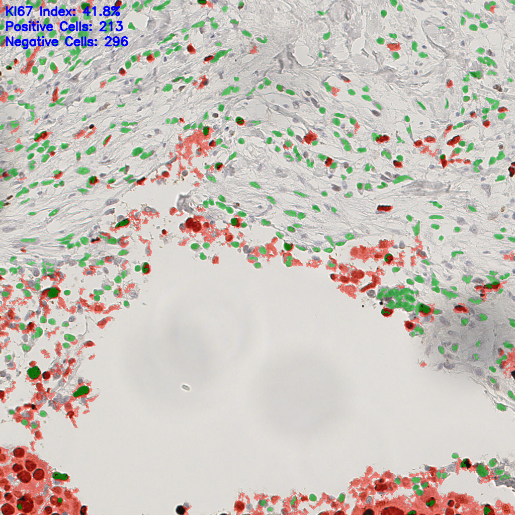 slice_48_14_x43008_y12544.png