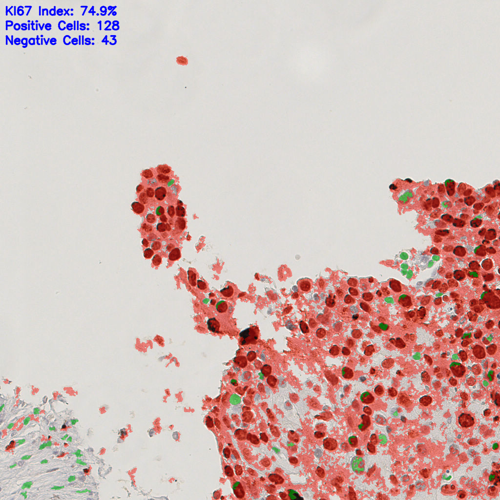 slice_48_3_x43008_y2688.png