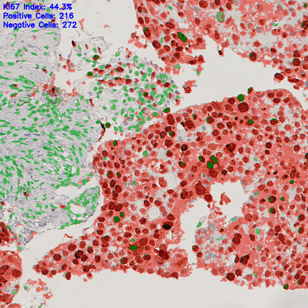 slice_48_4_x43008_y3584.png