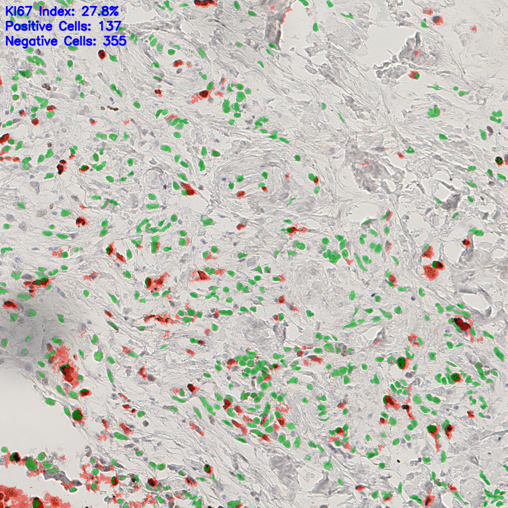 slice_49_14_x43904_y12544.png