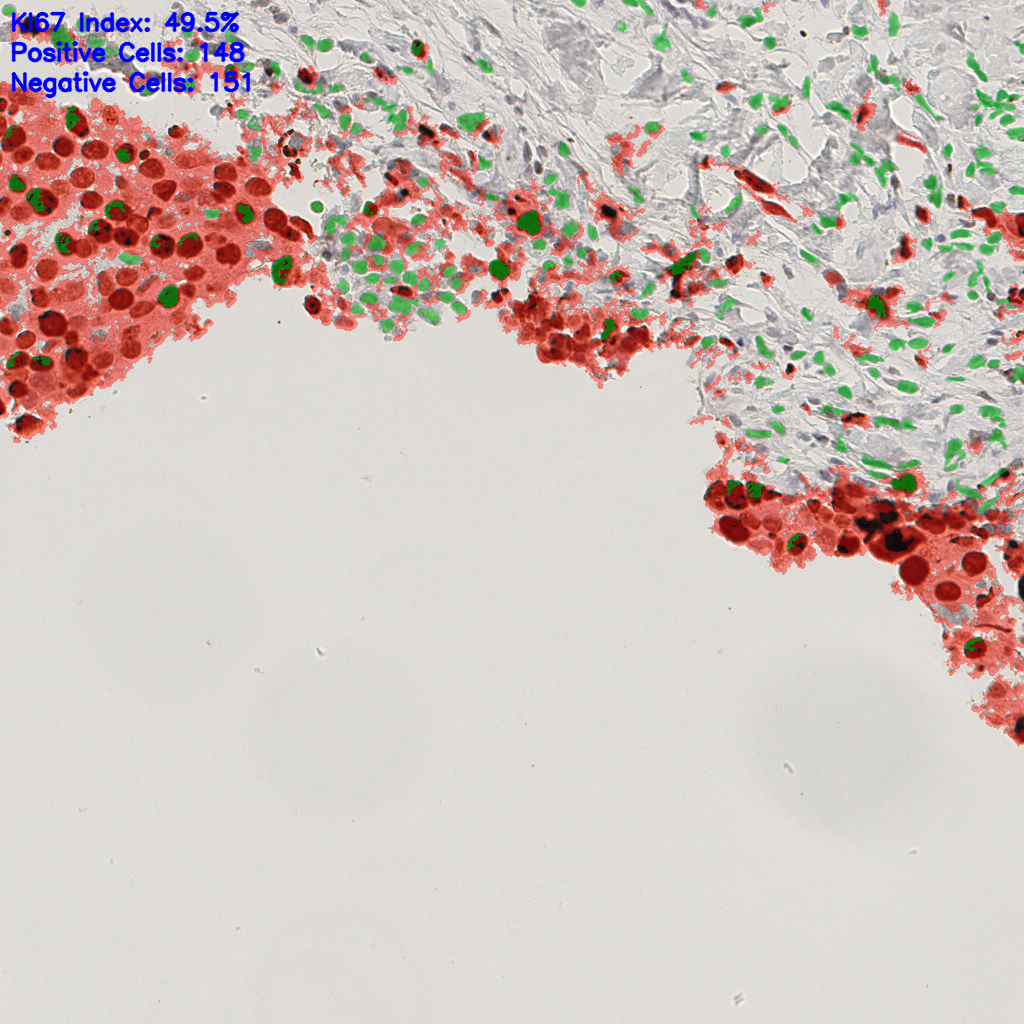 slice_49_15_x43904_y13440.png