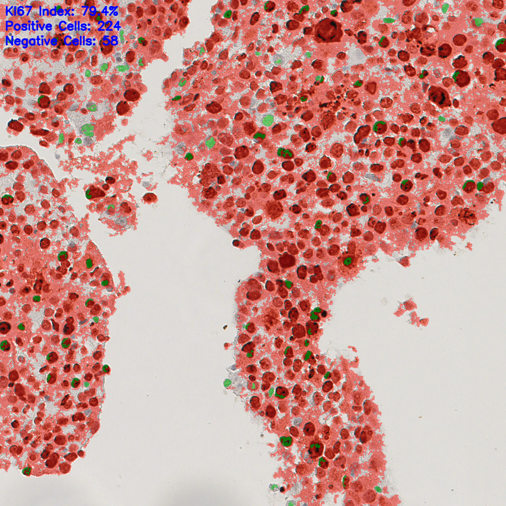 slice_49_4_x43904_y3584.png