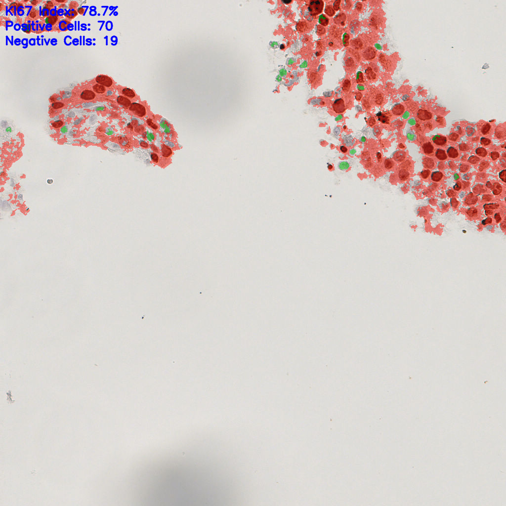 slice_49_5_x43904_y4480.png