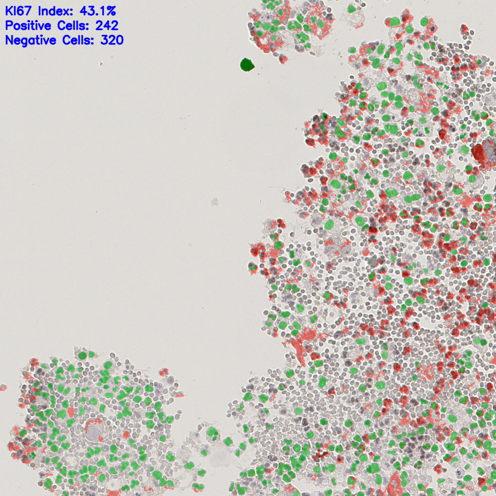 slice_4_14_x3584_y12544.png
