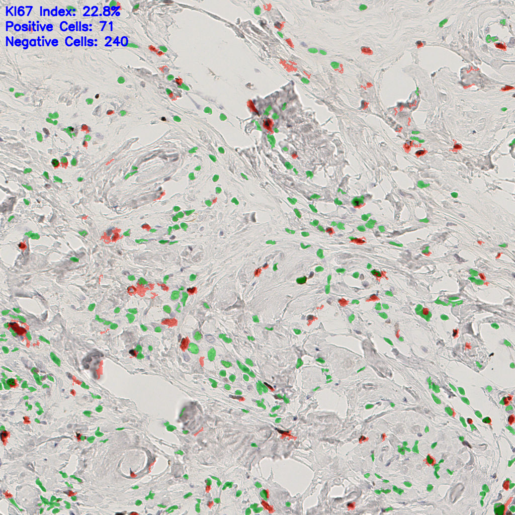 slice_50_14_x44800_y12544.png