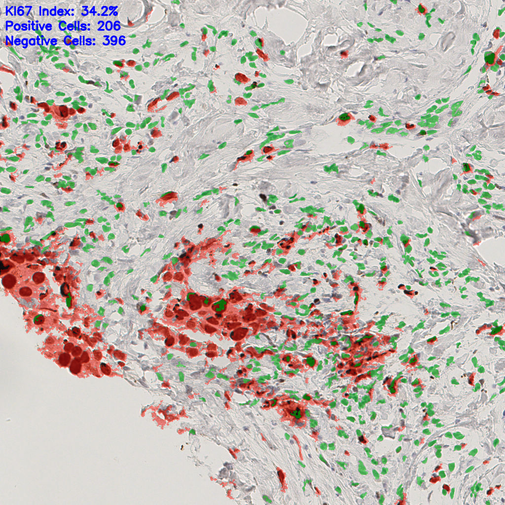 slice_50_15_x44800_y13440.png