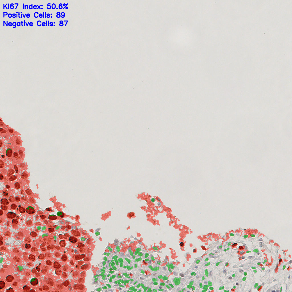 slice_50_3_x44800_y2688.png