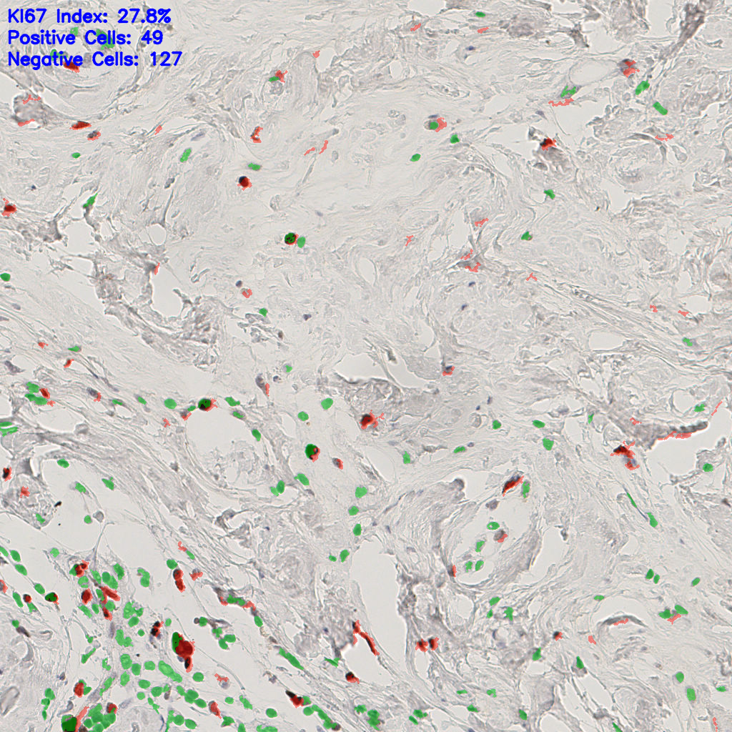 slice_51_14_x45696_y12544.png