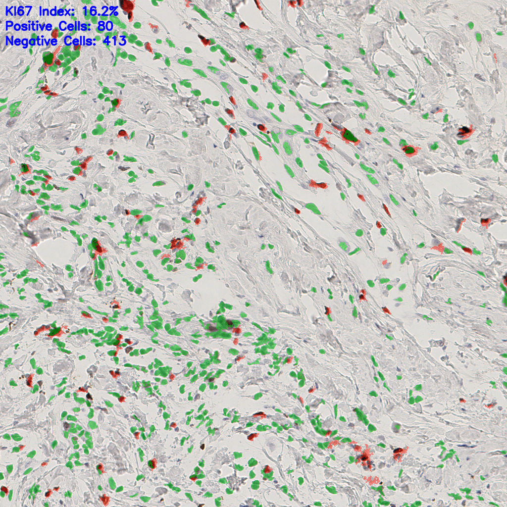 slice_51_15_x45696_y13440.png