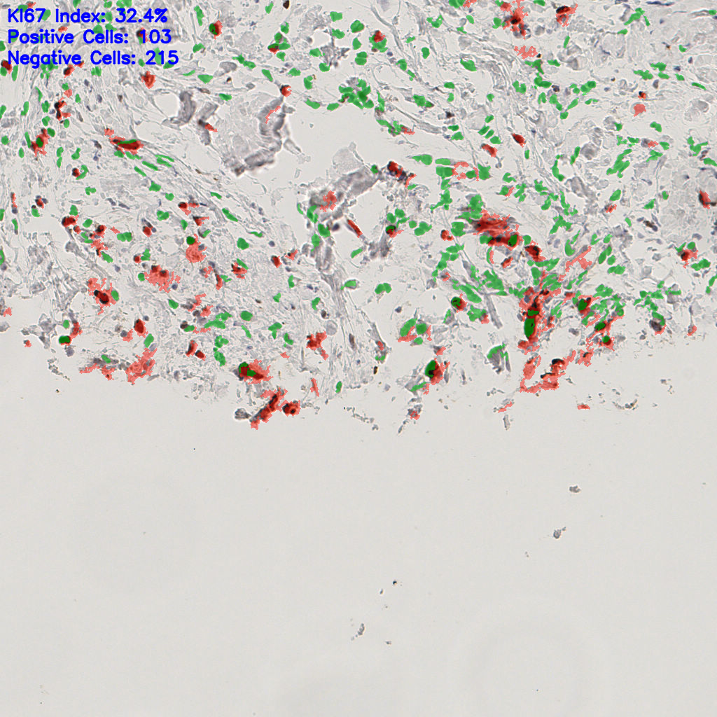 slice_51_16_x45696_y14336.png