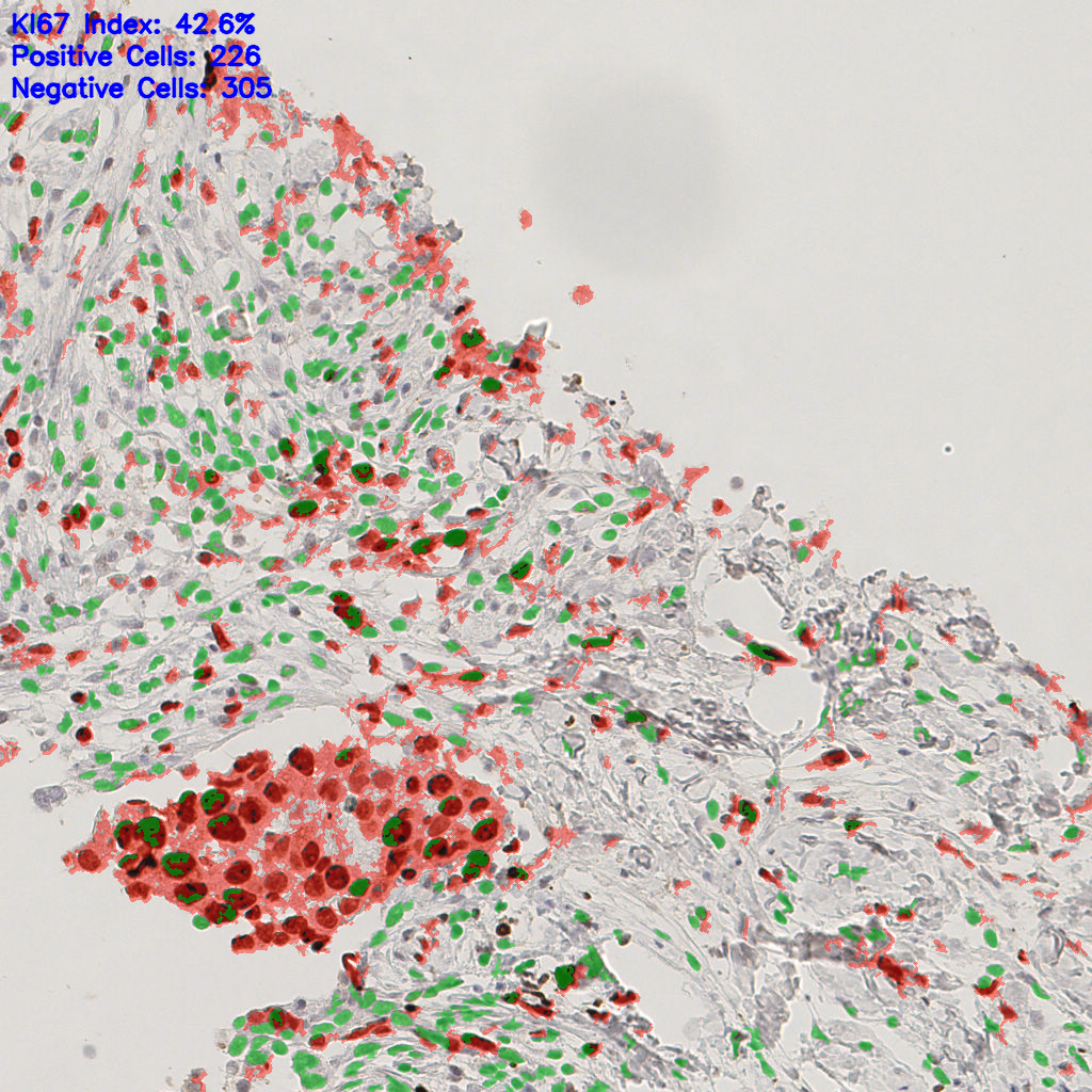 slice_51_4_x45696_y3584.png