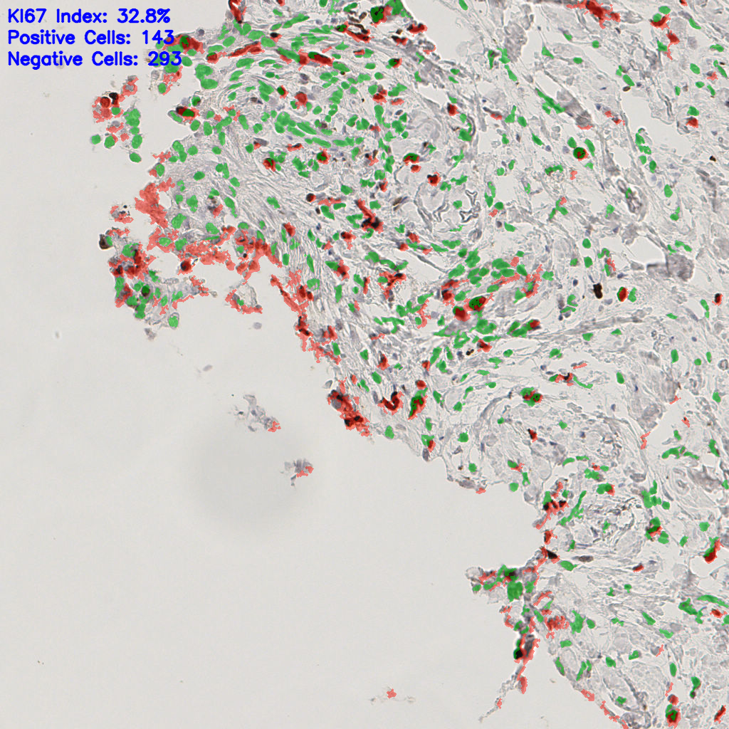 slice_51_5_x45696_y4480.png