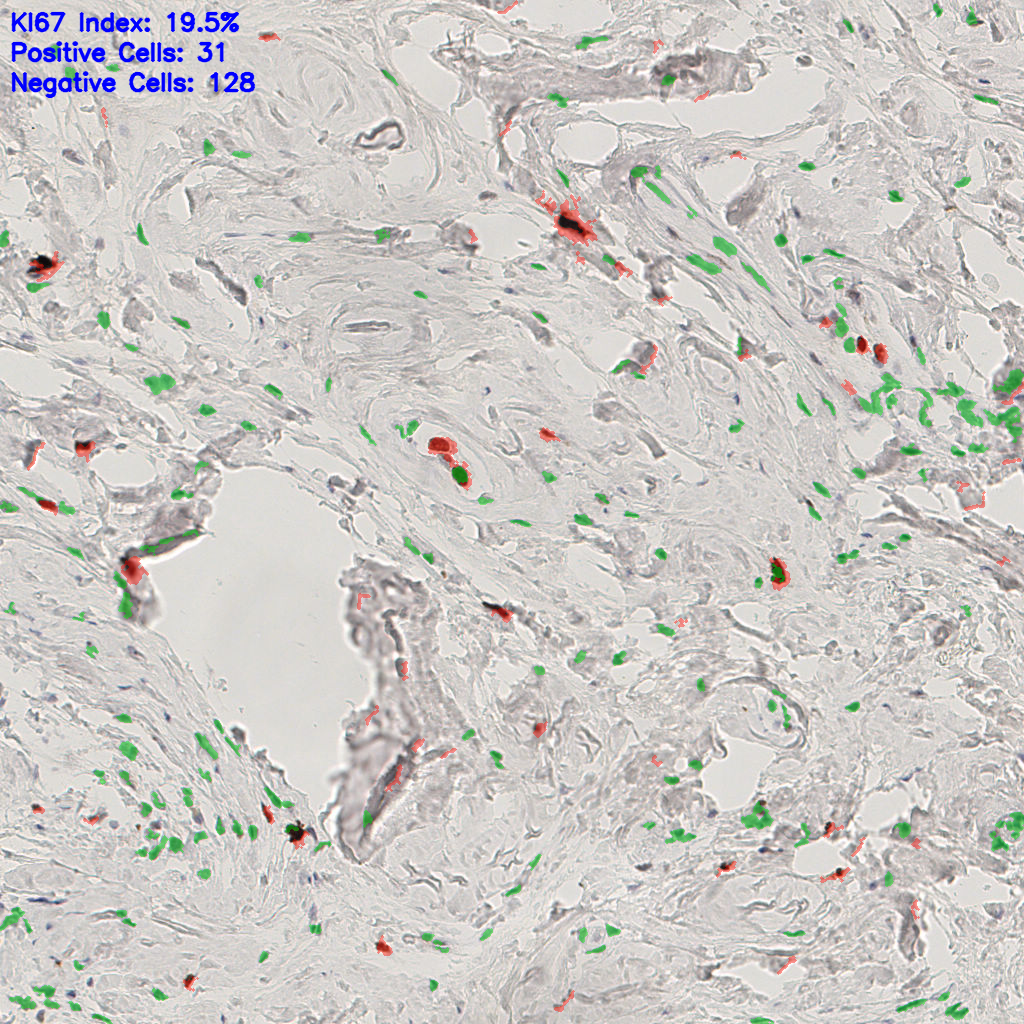 slice_52_15_x46592_y13440.png