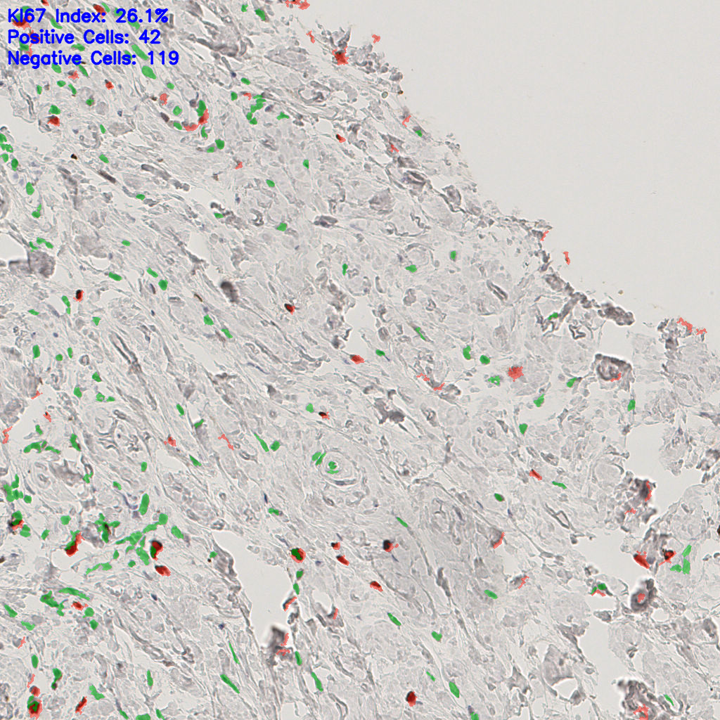 slice_52_5_x46592_y4480.png