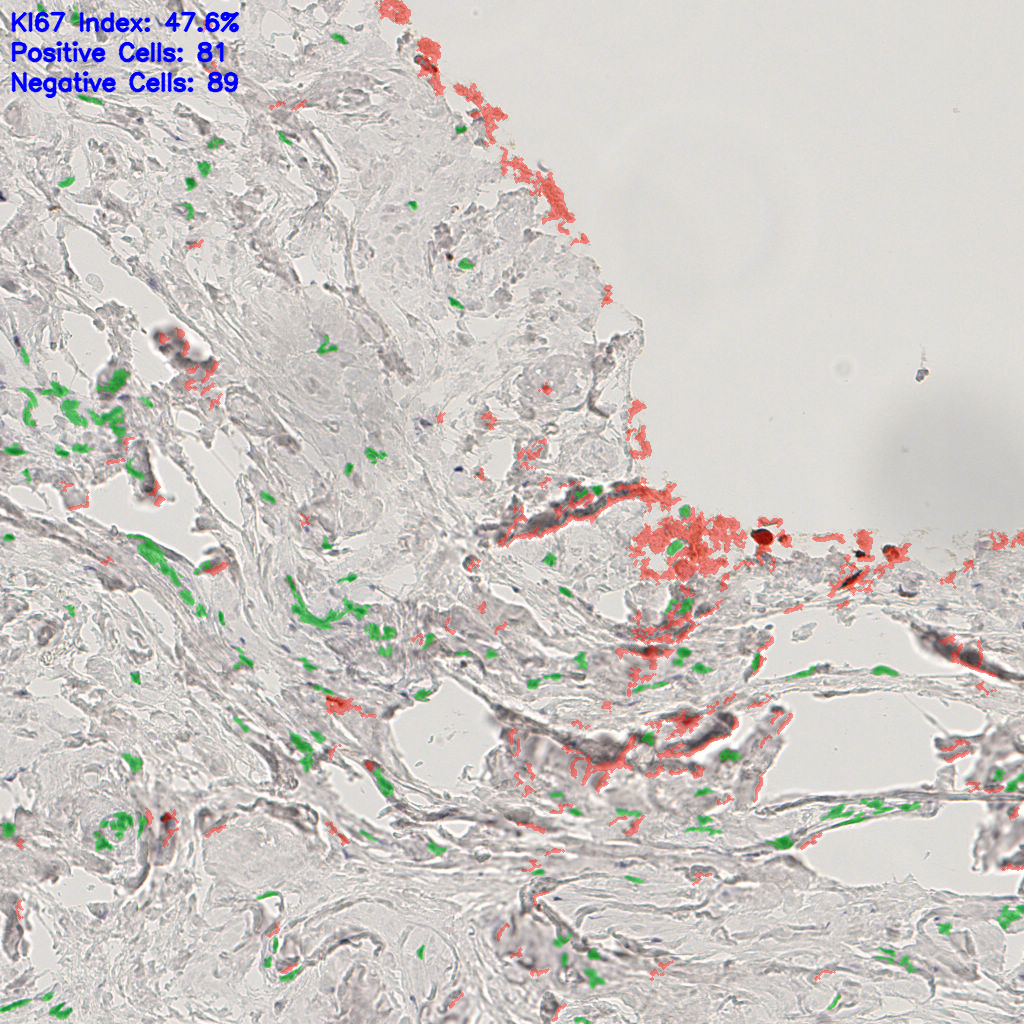 slice_53_15_x47488_y13440.png