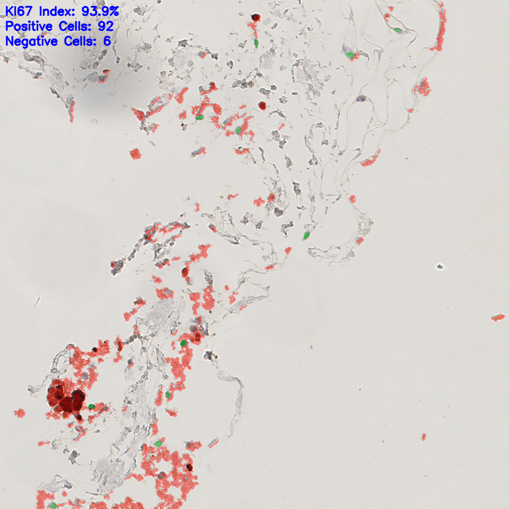 slice_55_13_x49280_y11648.png