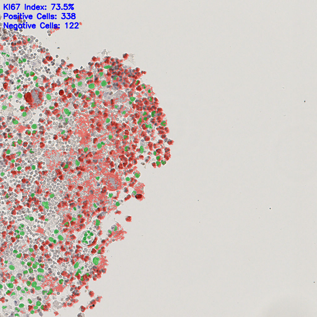 slice_5_14_x4480_y12544.png