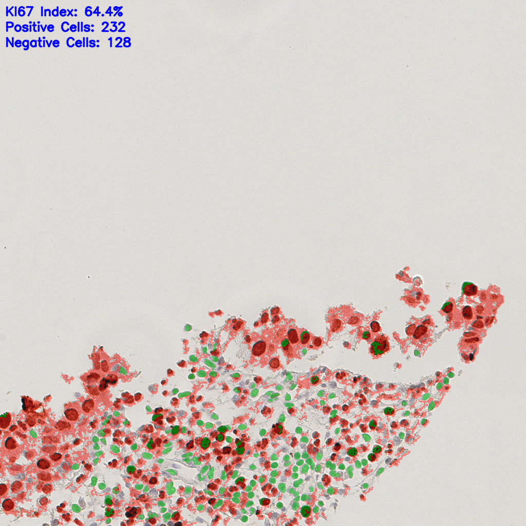 slice_5_26_x4480_y23296.png