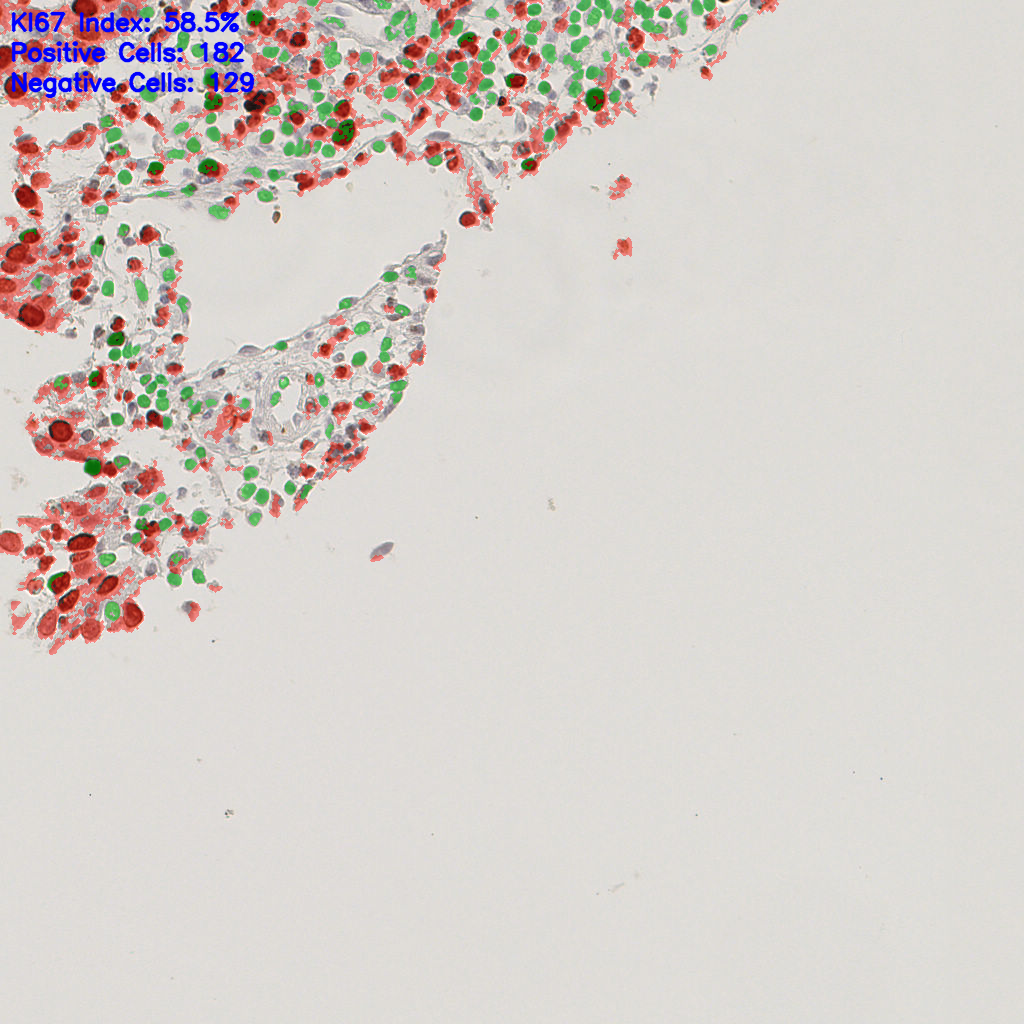 slice_5_27_x4480_y24192.png