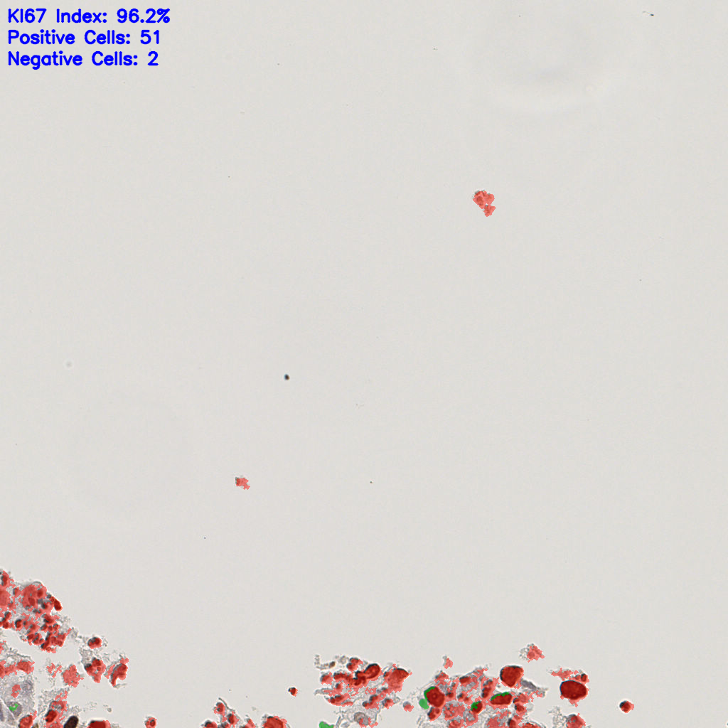 slice_7_17_x6272_y15232.png