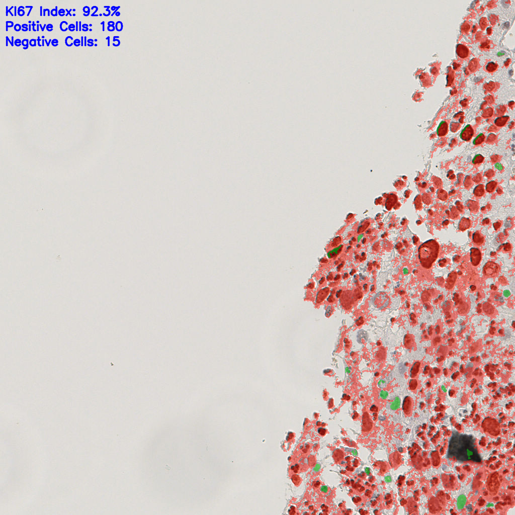 slice_7_20_x6272_y17920.png