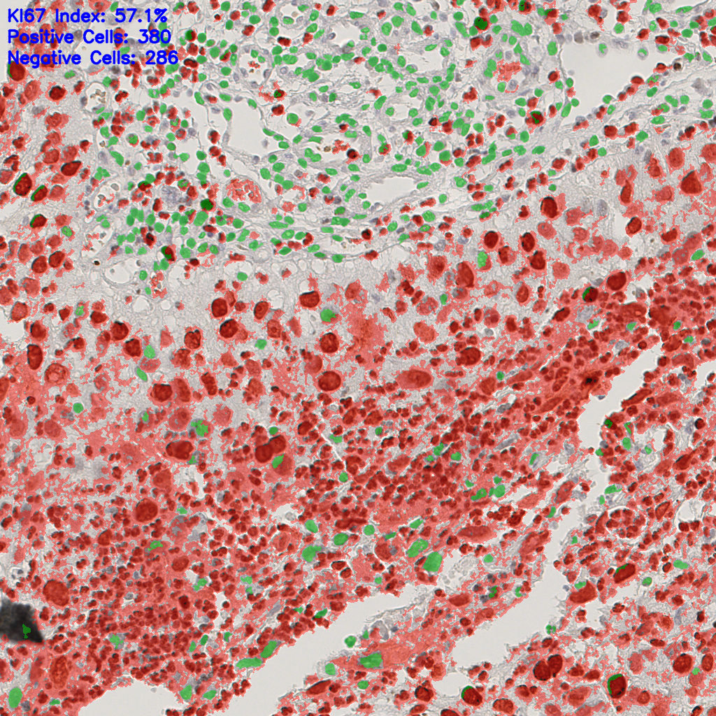 slice_8_20_x7168_y17920.png