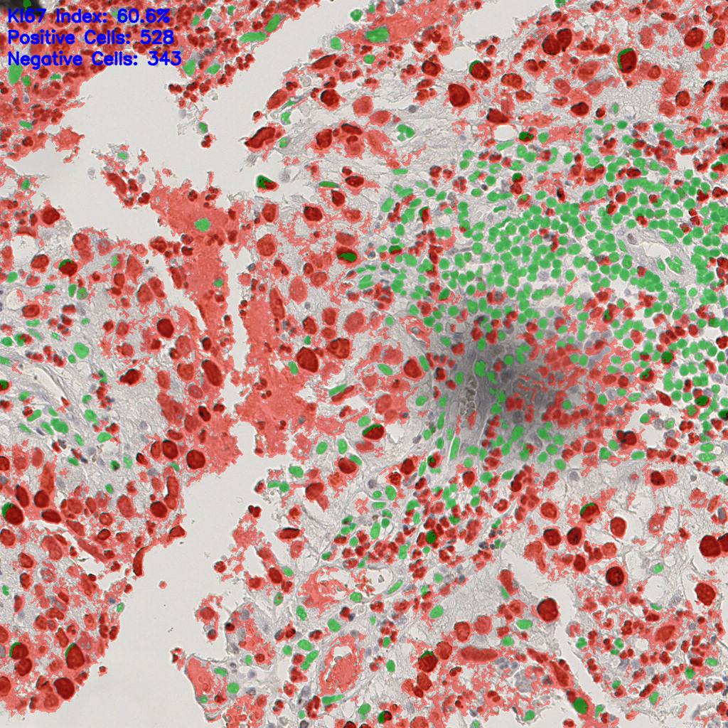 slice_8_21_x7168_y18816.png