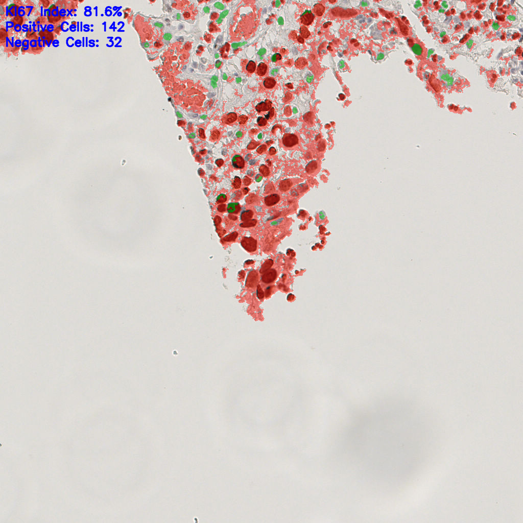 slice_8_22_x7168_y19712.png