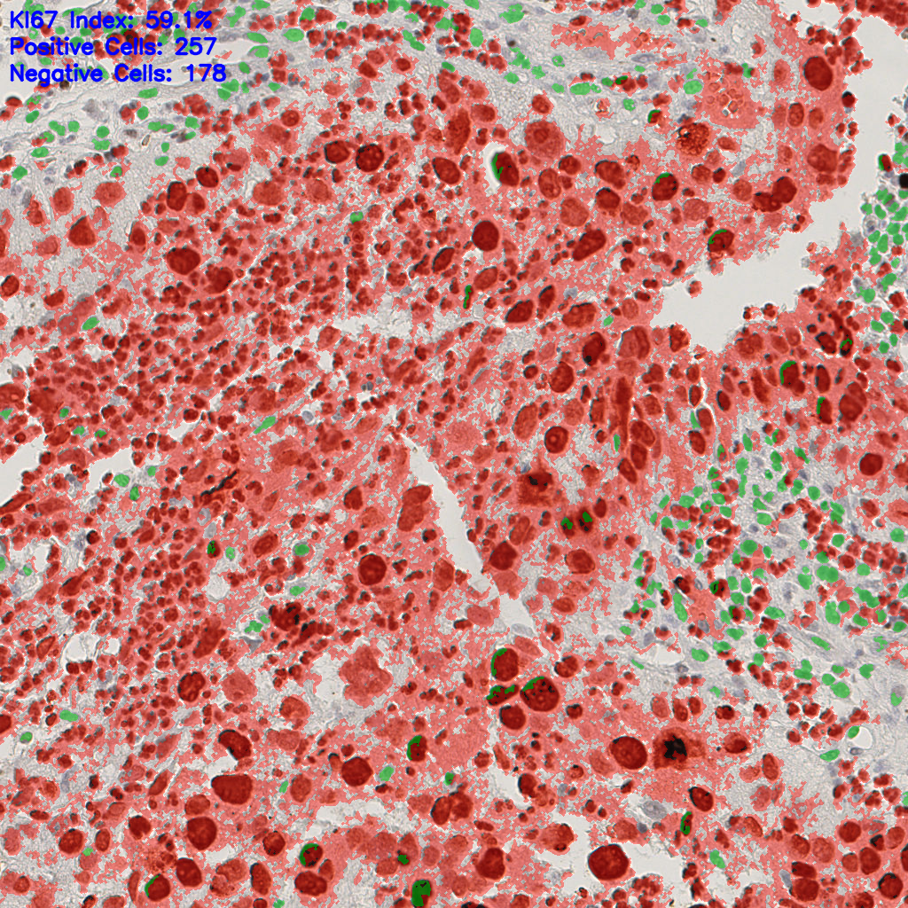 slice_9_20_x8064_y17920.png