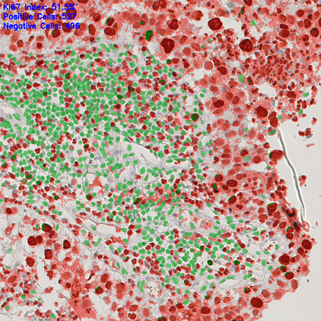 slice_9_21_x8064_y18816.png