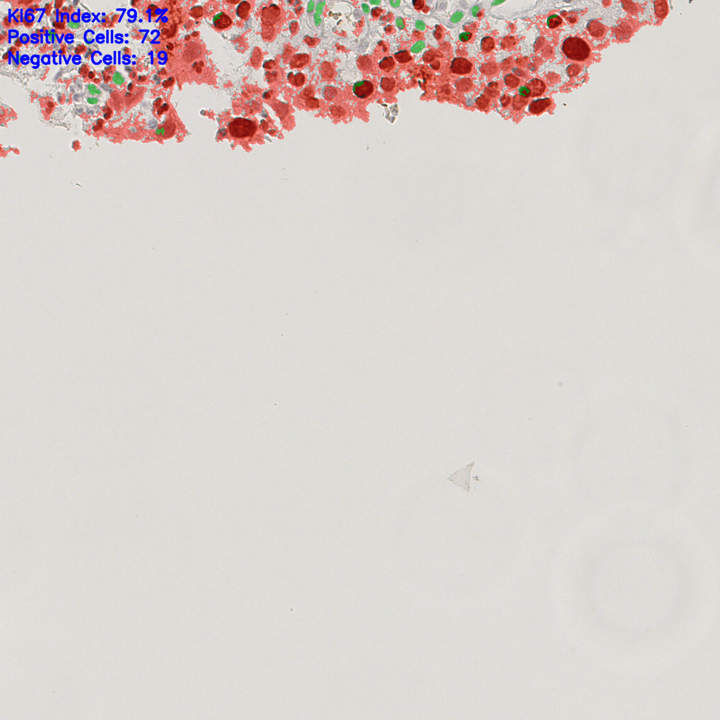 slice_9_22_x8064_y19712.png