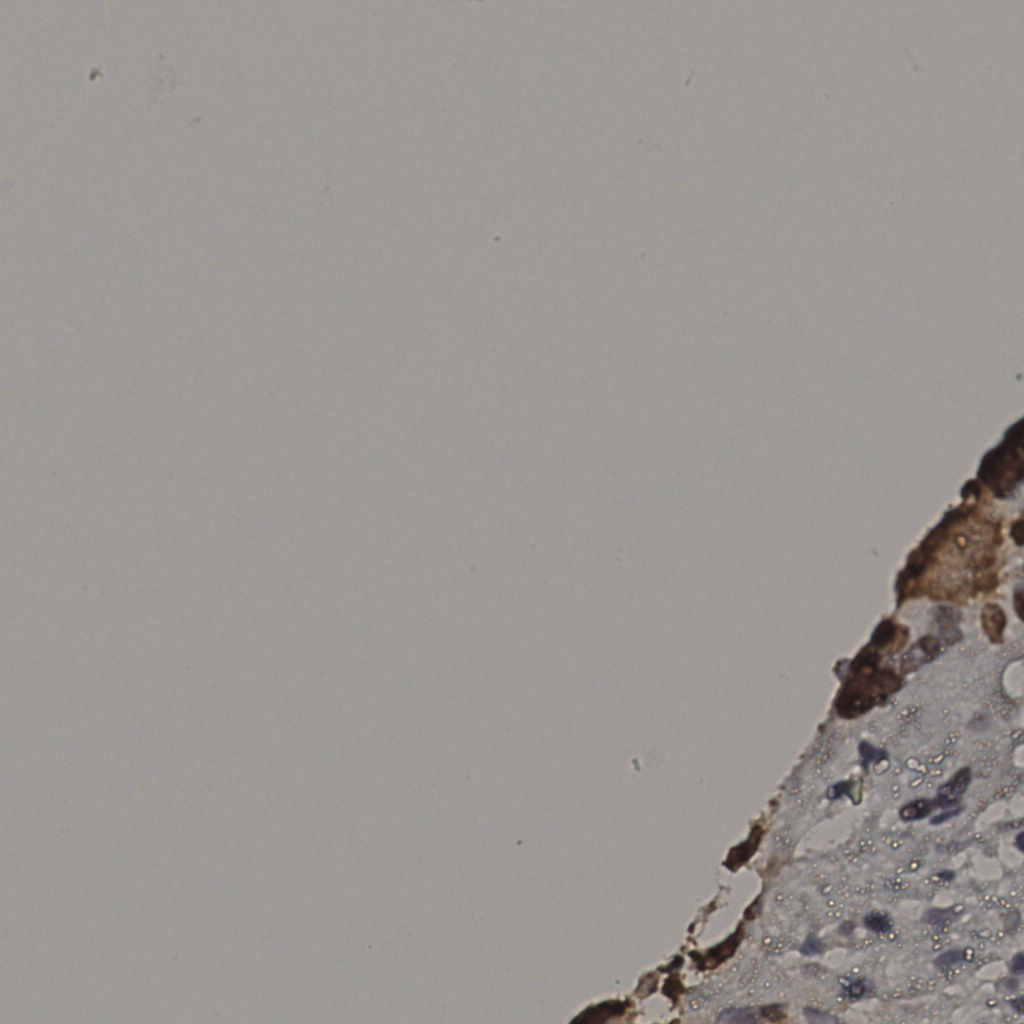 slice_10_45_x8960_y40320.png