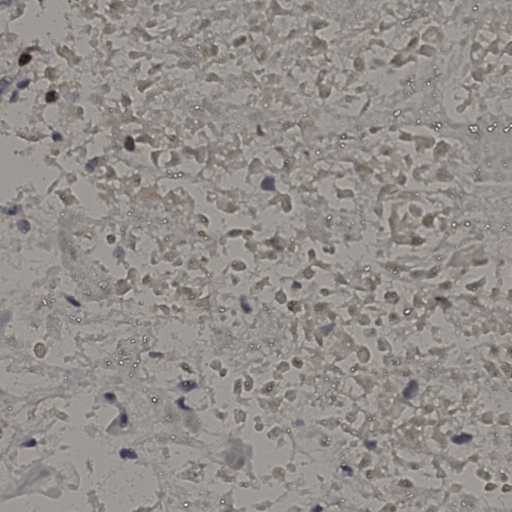 slice_15_48_x13440_y43008.png