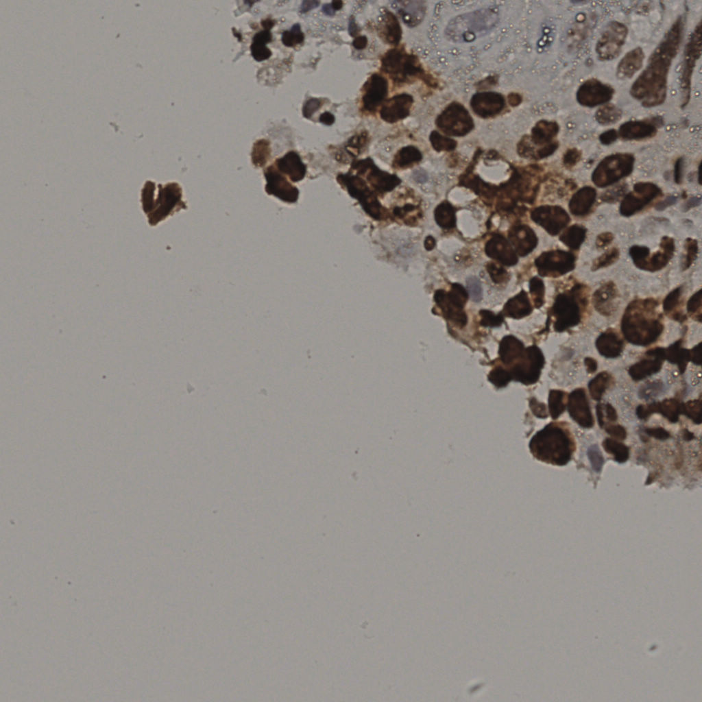 slice_15_56_x13440_y50176.png