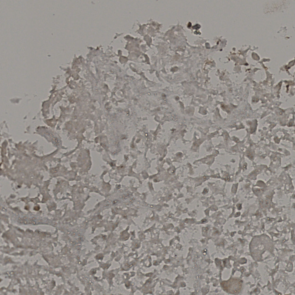 slice_16_38_x14336_y34048.png