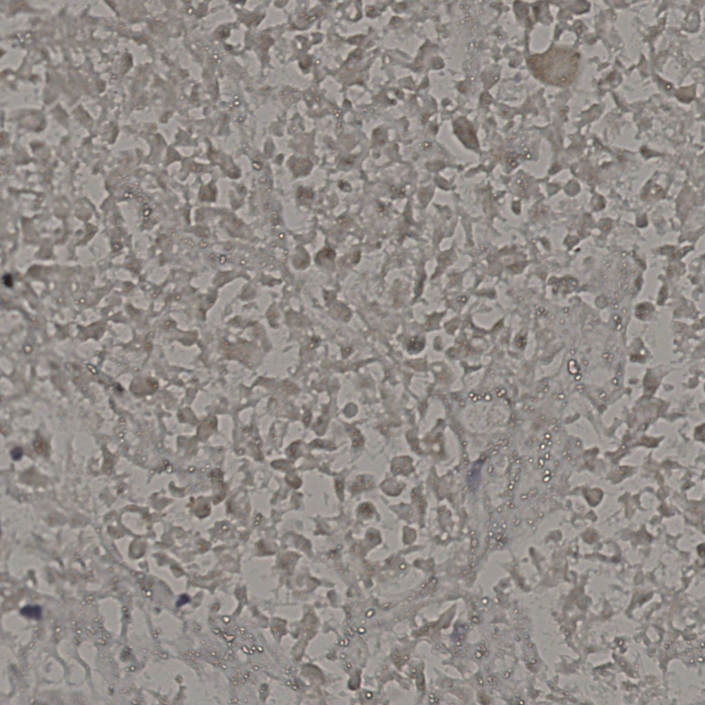 slice_16_39_x14336_y34944.png