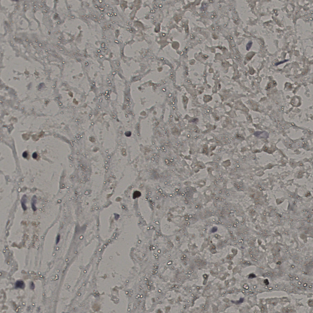 slice_16_40_x14336_y35840.png