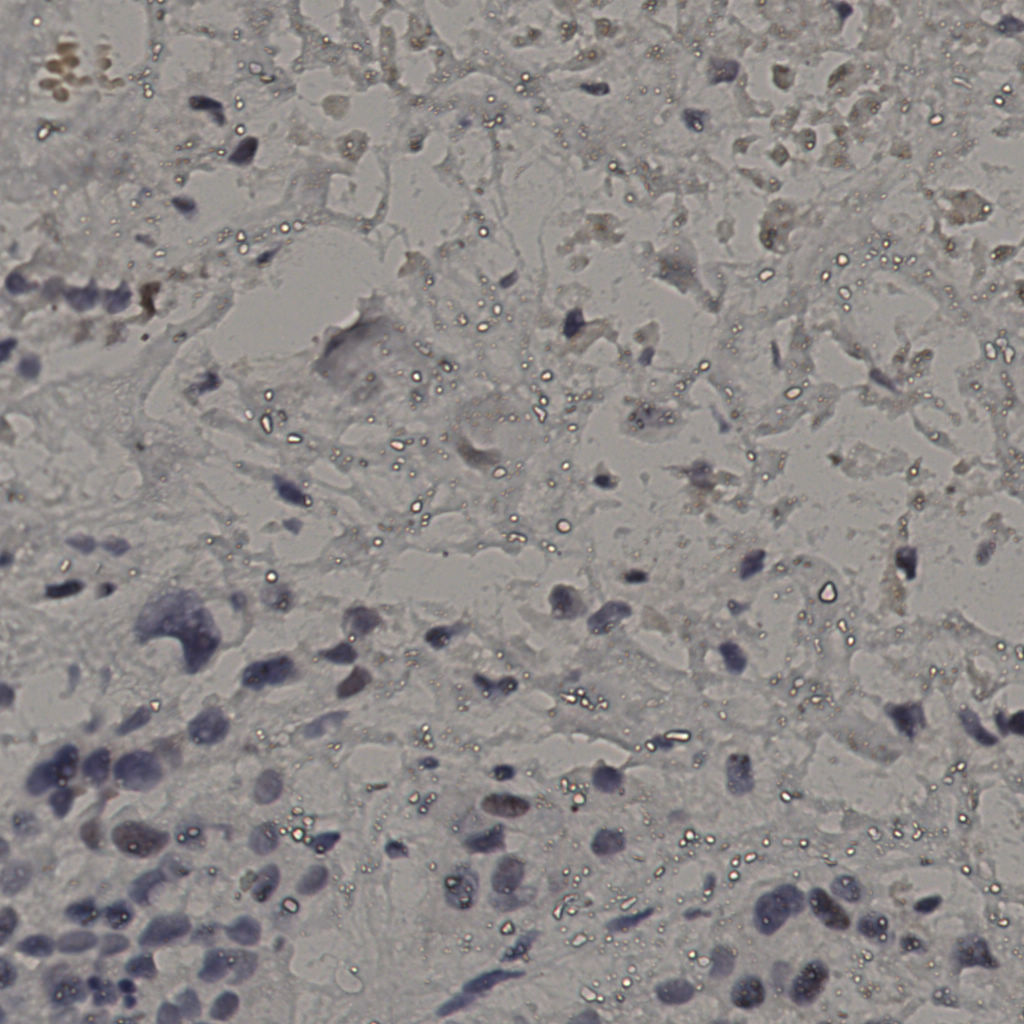 slice_16_42_x14336_y37632.png