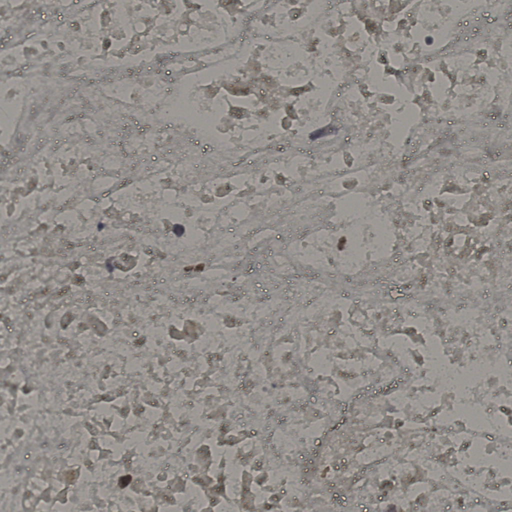 slice_16_47_x14336_y42112.png