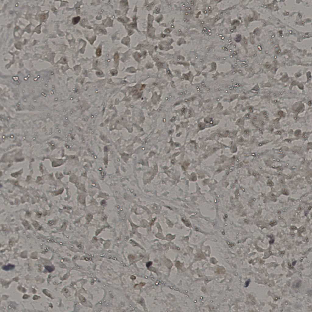 slice_16_48_x14336_y43008.png