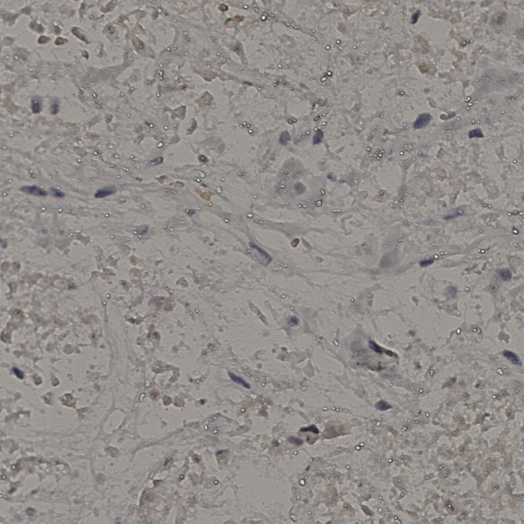 slice_16_49_x14336_y43904.png