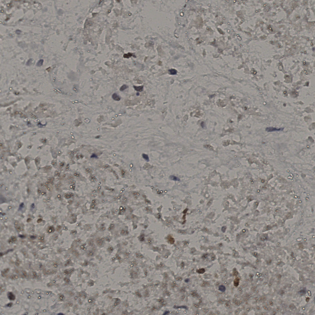 slice_16_50_x14336_y44800.png